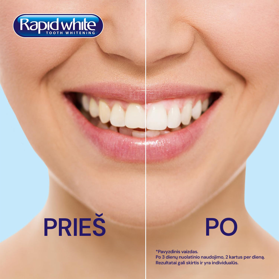 RAPID WHITE Bleaching Strips - balinamosios juostelės, 6 juostelių